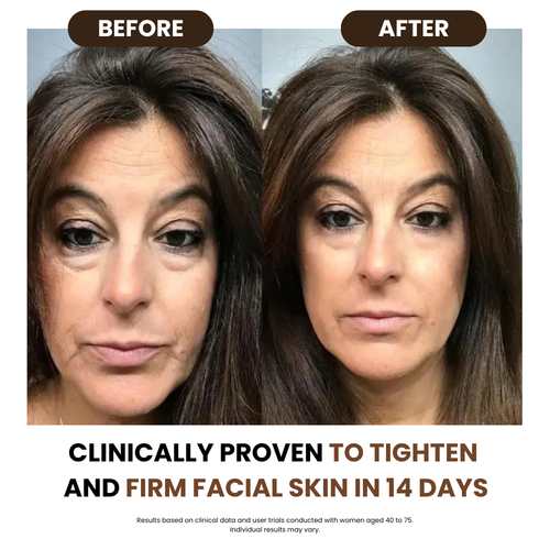 Lymphatic drainage brush