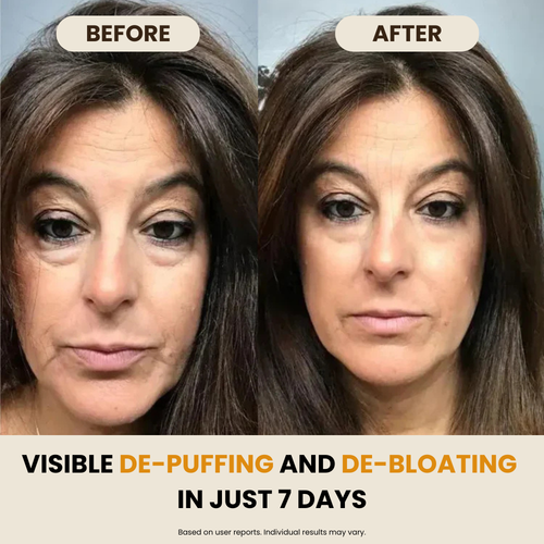 Lymphatic Drainage Wellness Drops