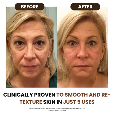 Lymphatic drainage brush